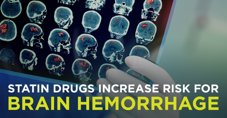 statins_increase_brain_hemorrhage_risk