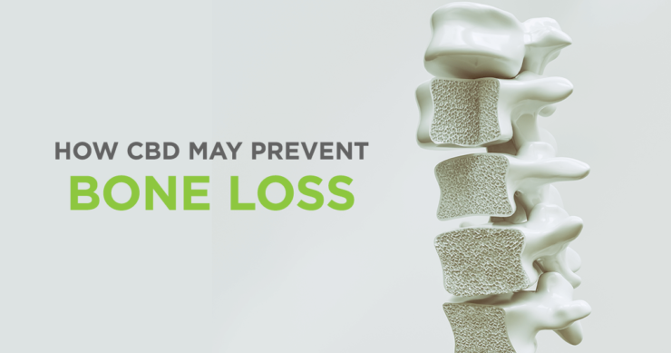 CBD and Osteoporosis – New Insights