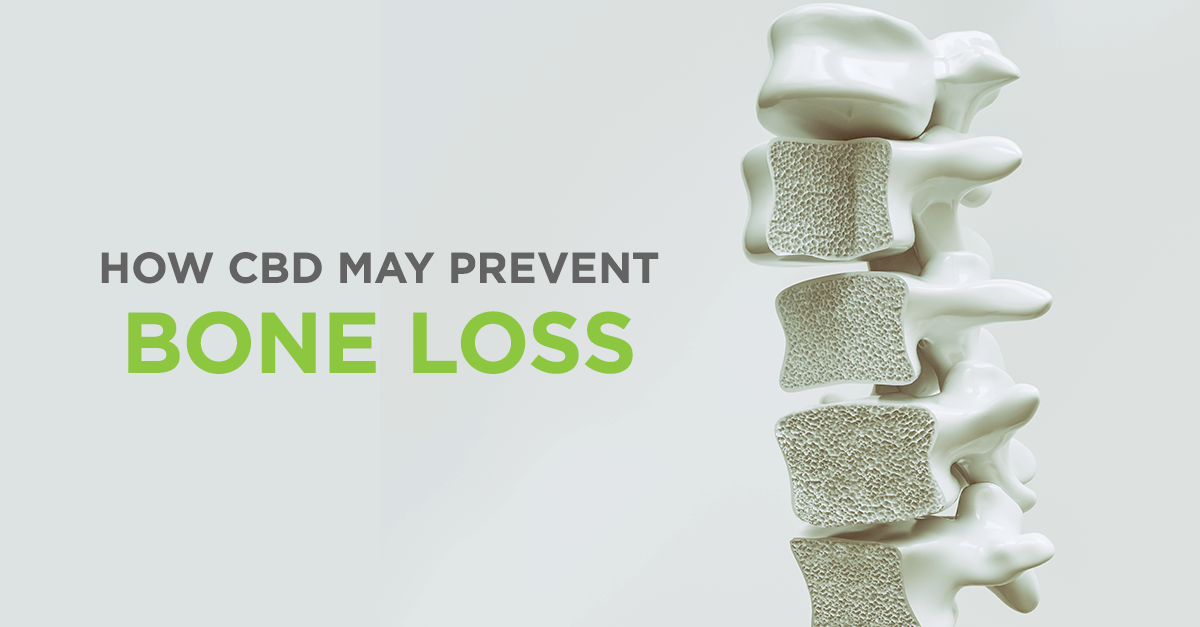 CBD_Prevent_Bone_Loss