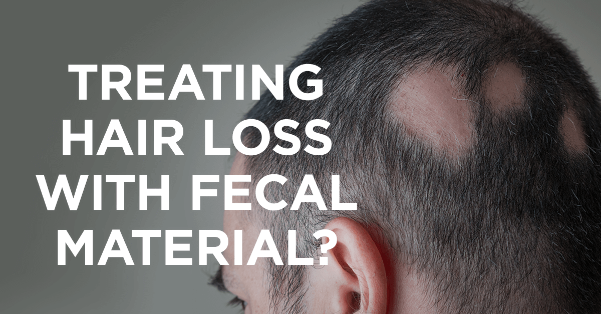 Treating-Hair-Loss-with-Fecal-Material-1-1